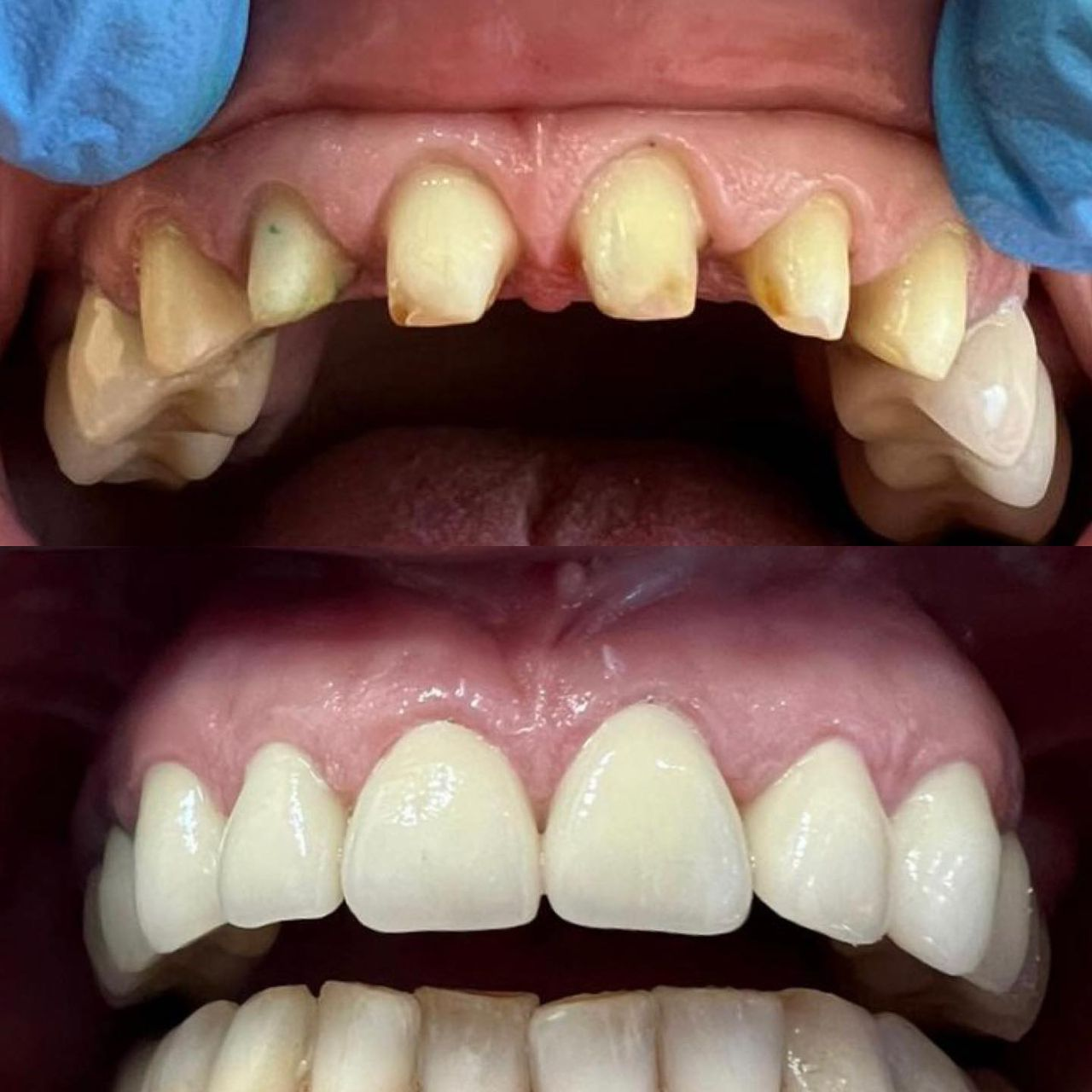 Case 5